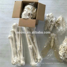 SKELETON10 (12371) Medical Science Full Size 170cm Unassembled Skeleton, Human Artificial Disarticulated Skeleton